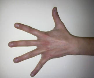 Hengerbucska - bal kézfej