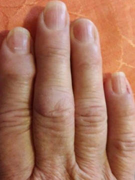 Jobb kéz - négy ujj